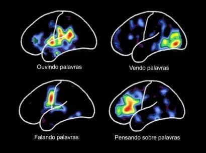 A Linguagem e o Cérebro: Confira as Principais Áreas Ativadas
